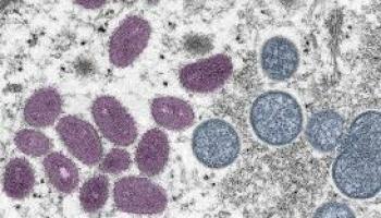 Mpox cells